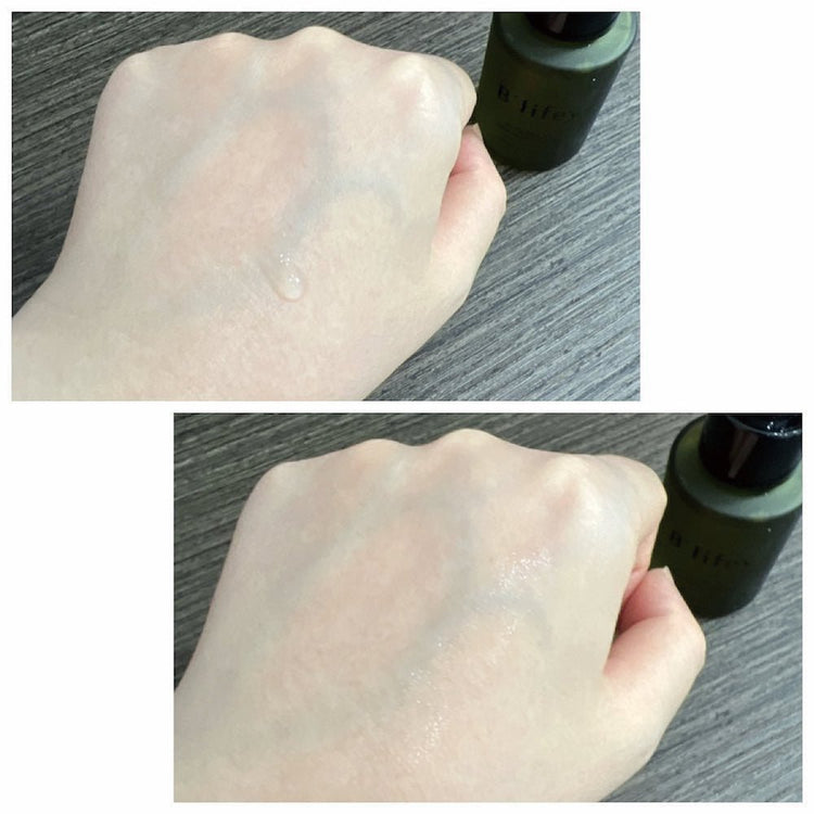 B'lifey – Swiss Acne Pimple Treatment Serum (Oil Control, Anti - Acne, Pore Minimizing, Exfoliants) (e30ml) BL003 - Beauty Online™ 肌齡喜源™