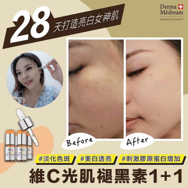 Derma Medream – Vita C+ Booster Treatment Serum (Whitening, Acne Marks, Sensitive, Antioxidant, Pore Minimizing, Firming, Brightening) (e10ml/Bottle*4 Bottles per Box) DM043 - Beauty Online™ 肌齡喜源™